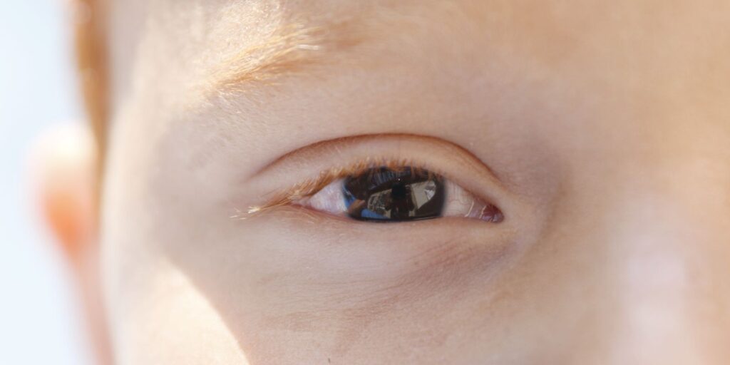 Erros de refração são principal causa de deficiência visual infantil